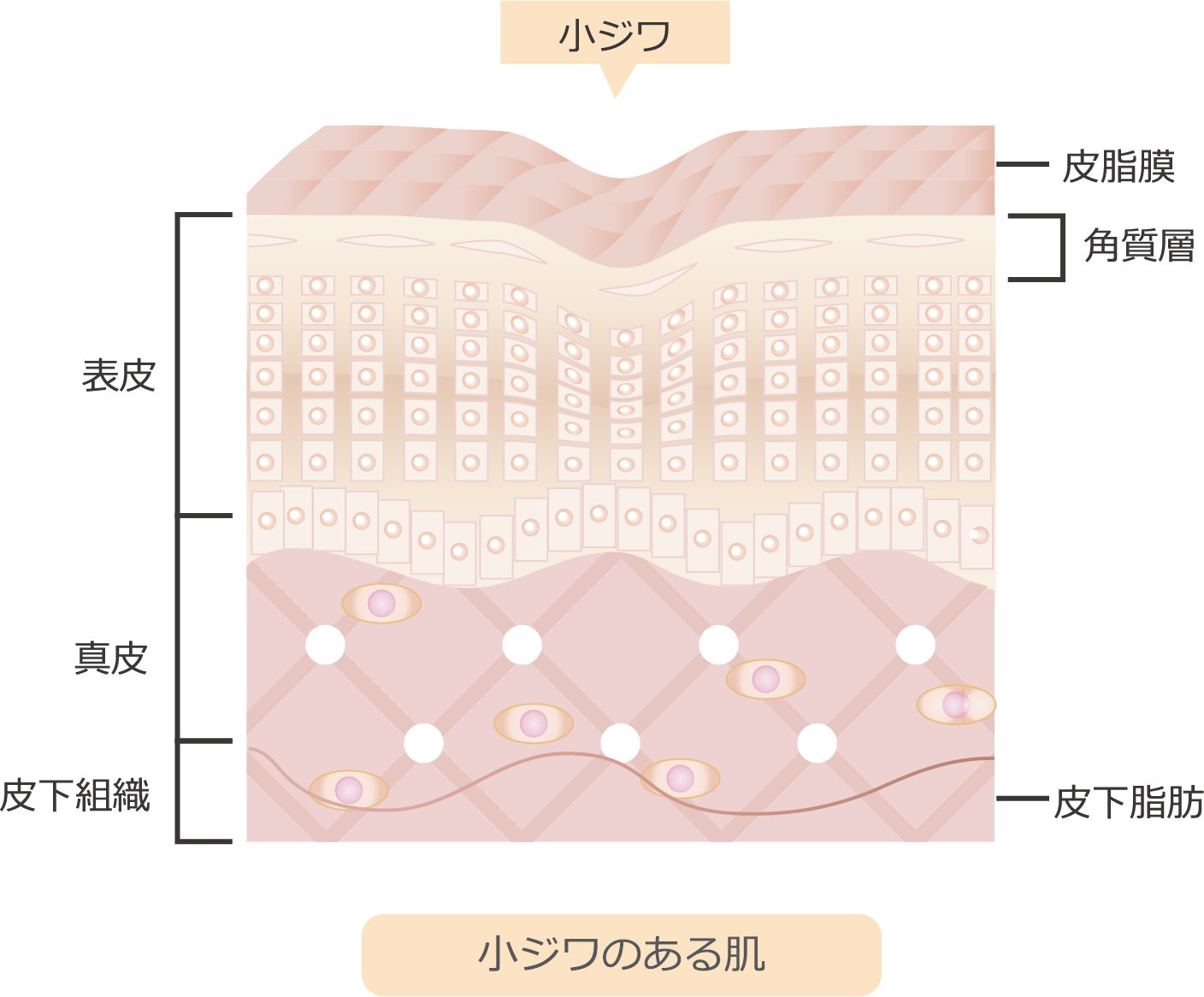 小ジワ 表皮 真皮 皮下組織 皮脂膜 角質層 皮下脂肪 小ジワのある肌